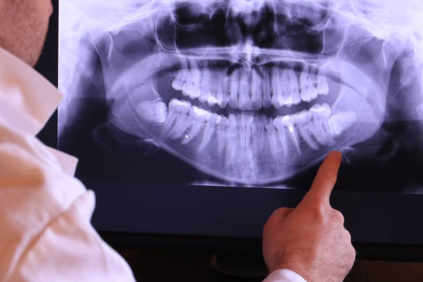 Best Chipped Tooth Repair Near Me  in Grant Valkaria, FL