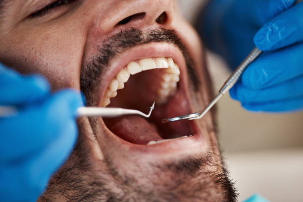 Best Tooth Infection Emergency Dentist  in Grant Valkaria, FL